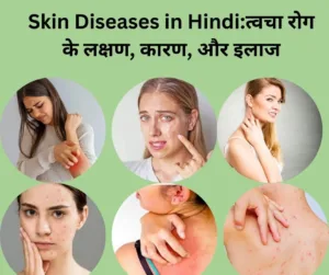 Skin-Diseases-in-Hindiत्वचा-रोग-के-लक्षण-कारण-और-इलाज