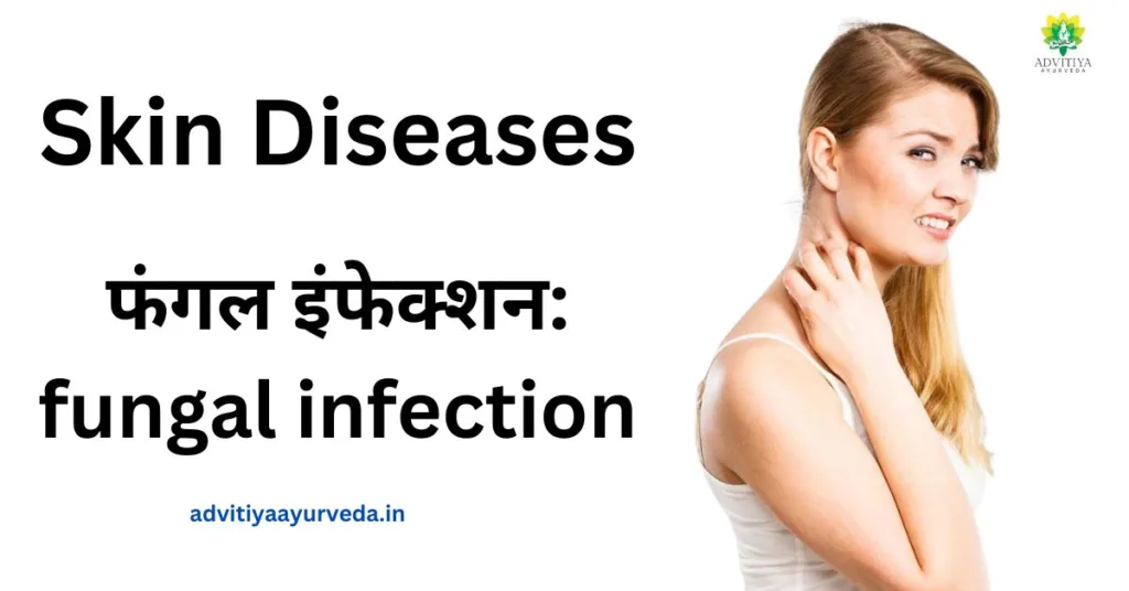 फंगल इंफेक्शन: fungal infection