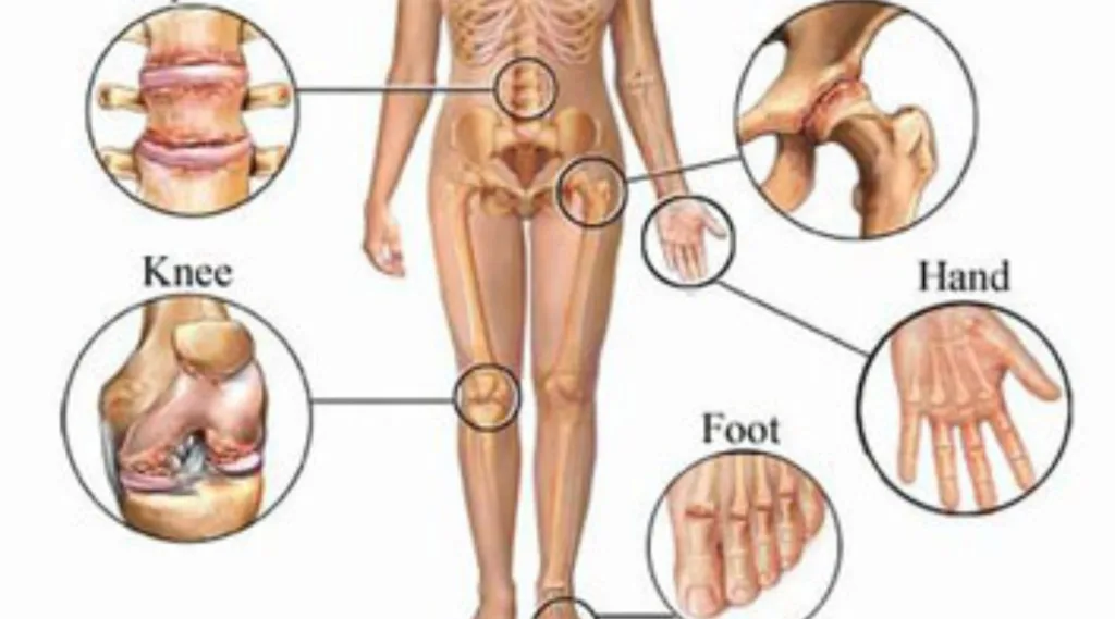 types of joint pain 